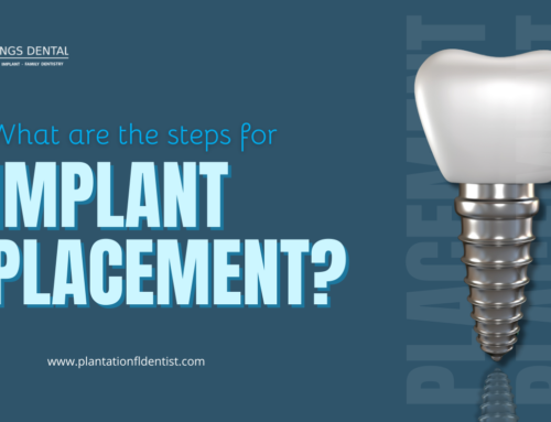 Implant placement in Plantation, FL