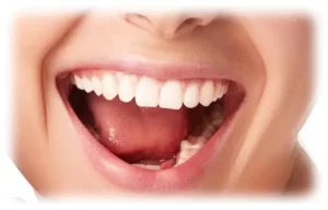 Close up photo of a woman smiling with straight white teeth